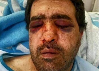 ביהמ''ש: הלינץ' בתושב חיפה, במהלך פרעות ''שומר חומות'' - לא ''מעשה טרור''